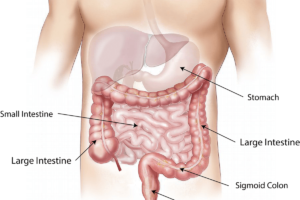 Disbiosi intestinale: dieta e cura