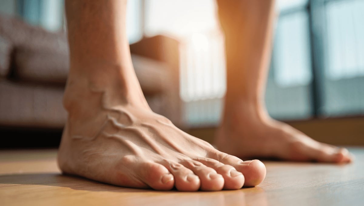 Piede piatto o alluce valgo? Aggiustali con 5 esercizi che allineano e rinforzano