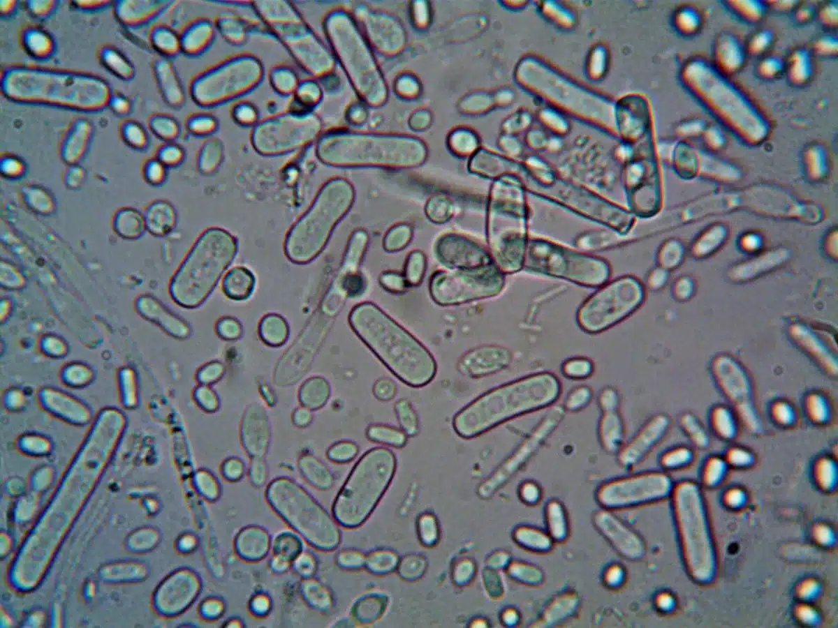Cellule batteriche del genere Vibrio al microscopio, visualizzate in dettaglio scientifico.