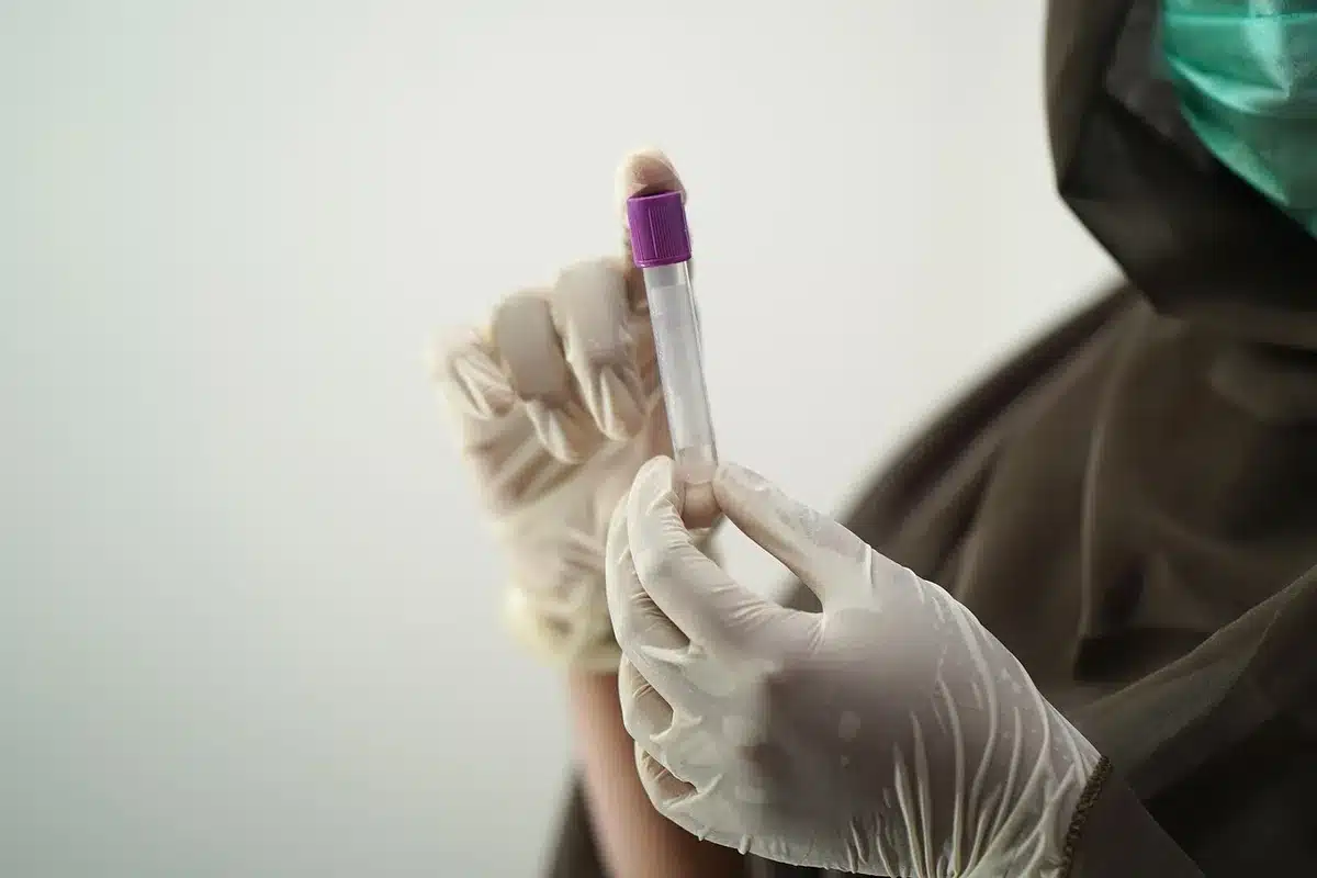 Personale sanitario che segnala un allerta alimentare e campione analitico in laboratorio